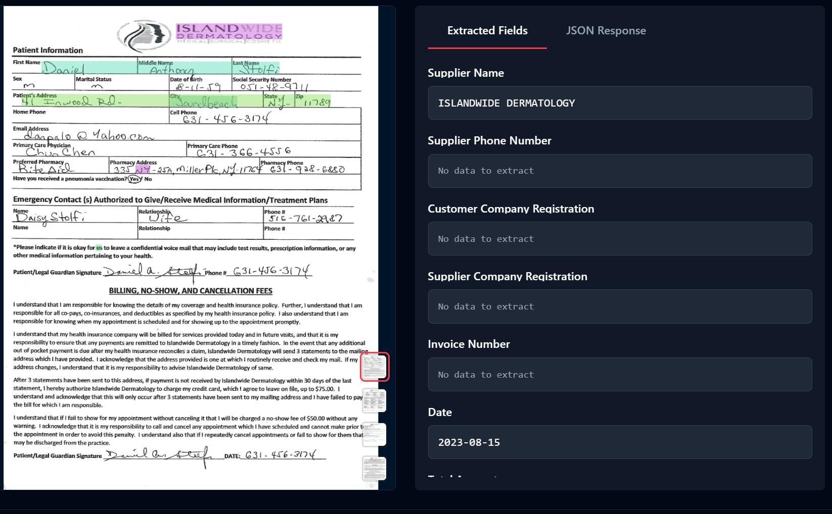 Mindee extraction showing 'No data to extract' for multiple fields on custom document