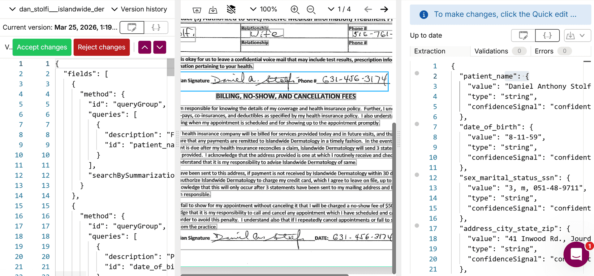 Sensible SenseML editor showing proprietary queryGroup and method syntax